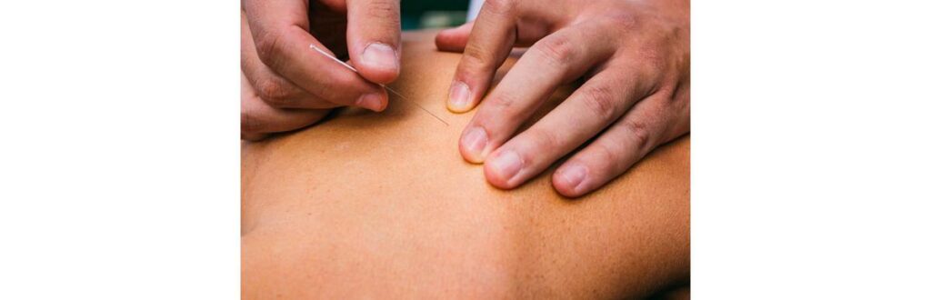 AGULHAS-DO-BEM_shutterstock_317136959