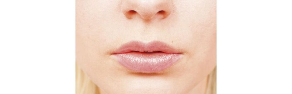 Foi constatado que o vírus estava ativo na saliva de infectados