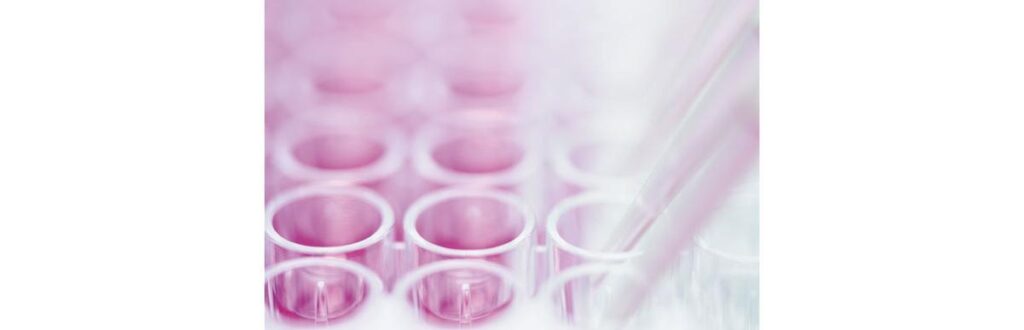 A nova técnica é direcionada a pacientes em tratamento oncológico