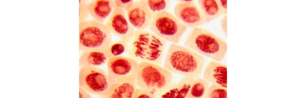 Abortos recorrentes podem ser causados falta de células tronco no endométrio, diz estudo