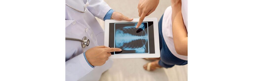 O efeito da radiação é somatório e varia de pessoa para pessoa