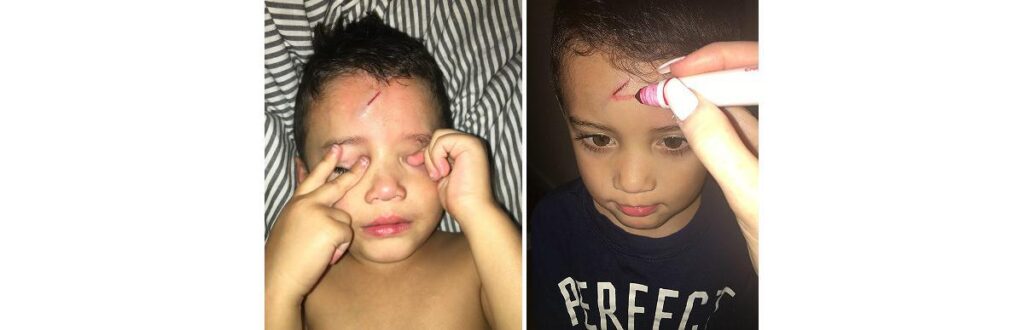 Ayden se machucou e não quis mais sair de casa até a mãe ajudar (Foto: Reprodução Imgur)