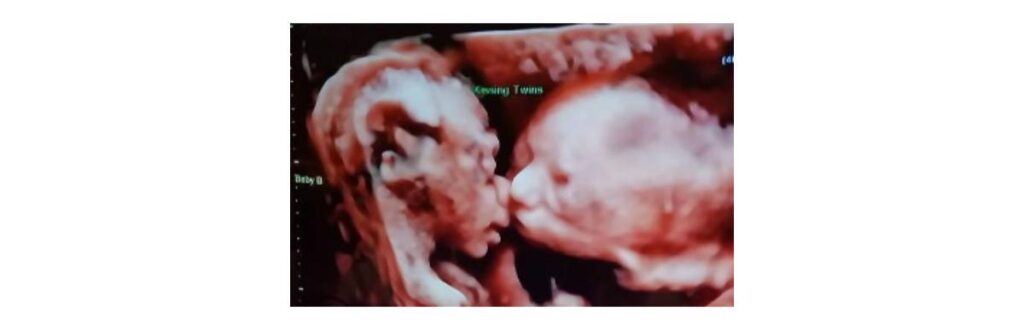 Os pais ficaram surpresos e emocionados