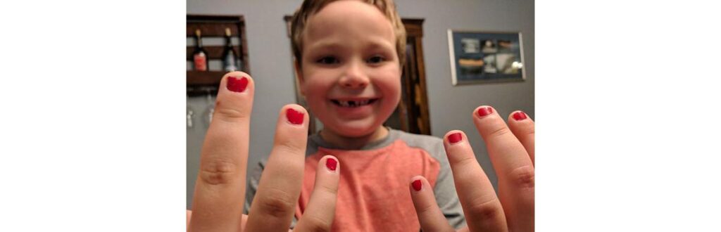 Menino gosta de pintar as unhas e sofre bullying na escola