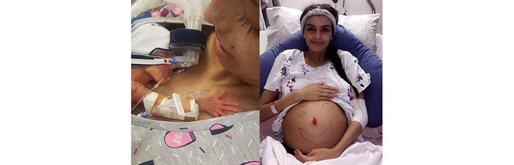 Brianna Rawilings deu a vida ao pequeno Kyden, aos 6 meses de gestação.