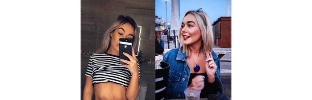 Menina se fantasiou de endometriose no Halloween para falar de sua condição