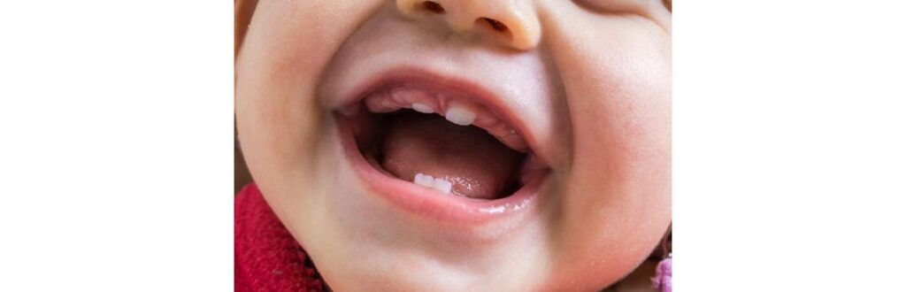 O cuidado bucal deve ser feito desde os primeiros anos de vida