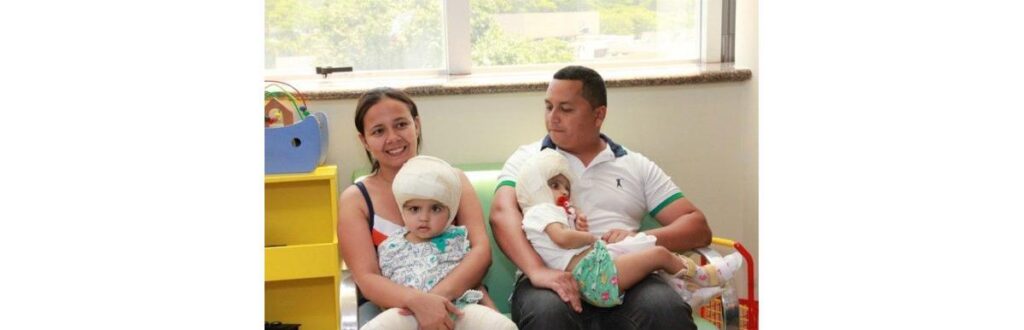Pais celebram o sucesso da cirurgia de separação das filhas