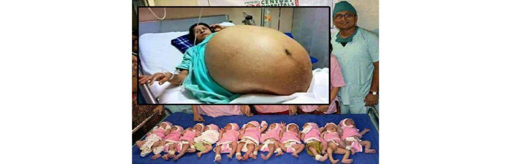 A mulher teria dado à luz 11 crianças