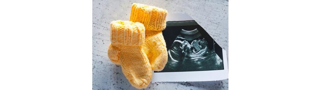 Os abortos são comuns em ao menos 20% das mulheres