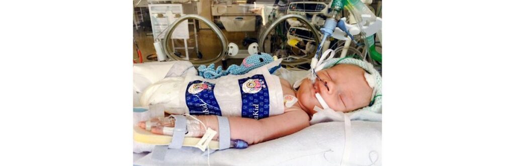 Kaleb com 10 dias no Hospital Rainbow