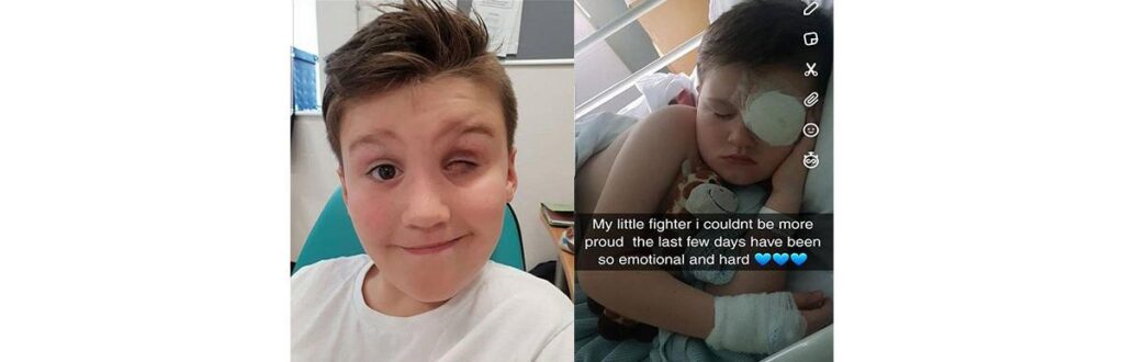 Taylor foi atingido no mesmo olho duas vezes