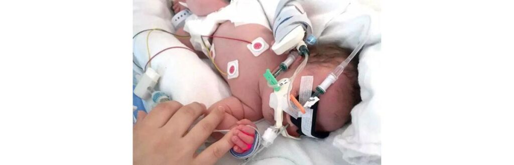 A doença não impede que Lilien exiba seu sorriso lindo e contagiante