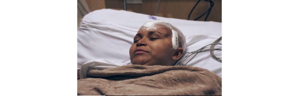 Michele após cirurgia de colocação da prótese