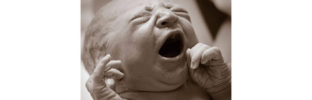 Você sabe o que é parto empelicado?