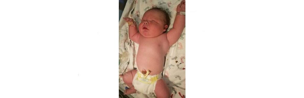 Bebê de 7kg nasce nos Estados Unidos