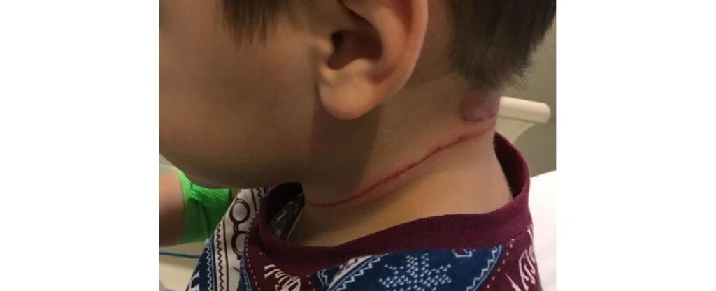 Arika desabafou após seu filho se machucar com a cortina