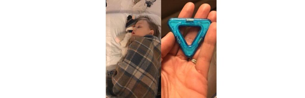 Criança engoliu 13 ímãs