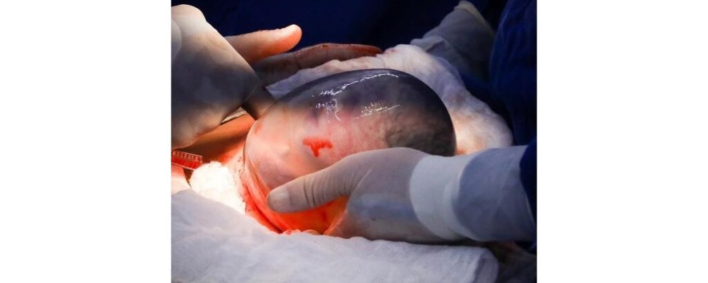 Os partos de 2018 foram memoráveis