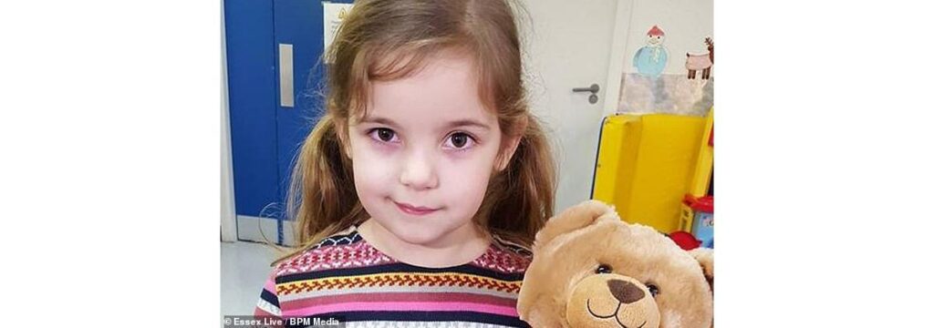 Shai nasceu com uma condição rara