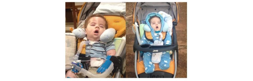 O tratamento de Anthony custa, em média R$400 mil