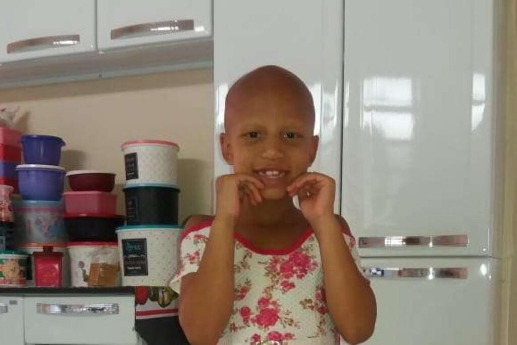 Bianca, tem doença rara que causa perda dos pelos no corpo