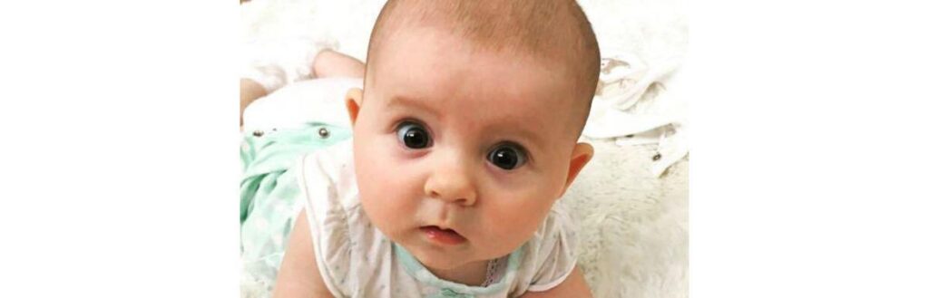 Bebê de 1 ano tem diagnosticado ruim