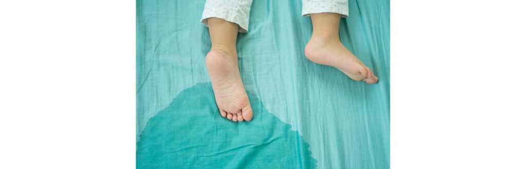 A enurese noturna atinge cerca de 15% das crianças com mais de 5 anos