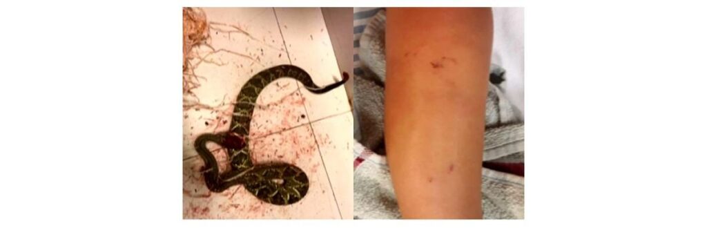 A cobra que picou Carlos Henrique
