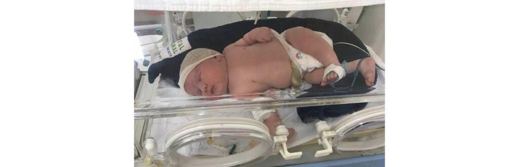 O menino veio ao mundo através de um parto cesárea