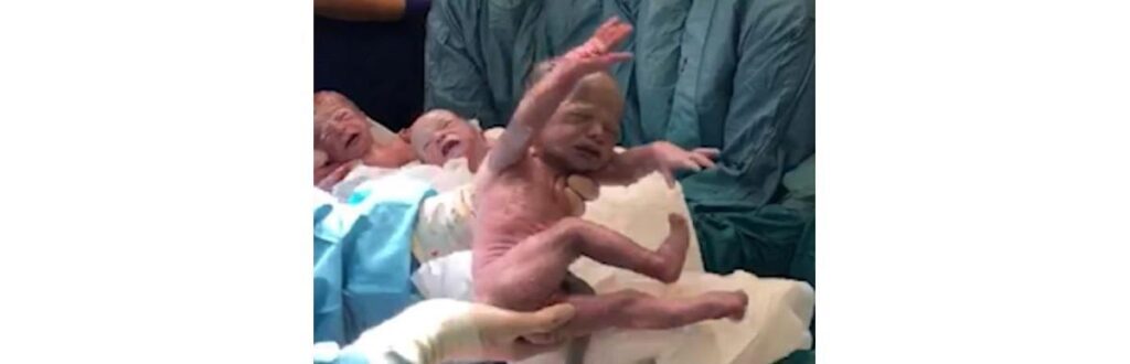 Sonny, Sidney e Betsy nasceram em 20 de março