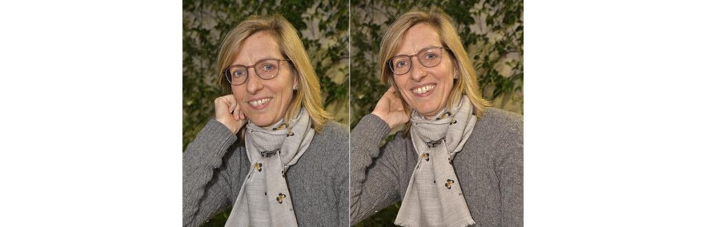 “O câncer de mama faz parte da minha história. Quando me perguntam se eu escolheria reescrever minha vida sem esse capítulo, eu respondo que não”