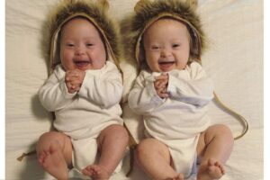 Rachel fala sobre ter filhas gêmeas com Down