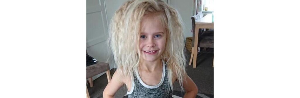 Wynter Seymour tem uma condição muito rara