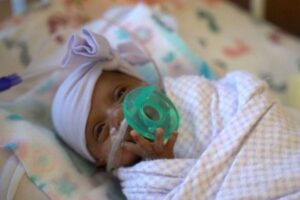 A bebê recèm-nascida pesava o mesmo que uma grande maça