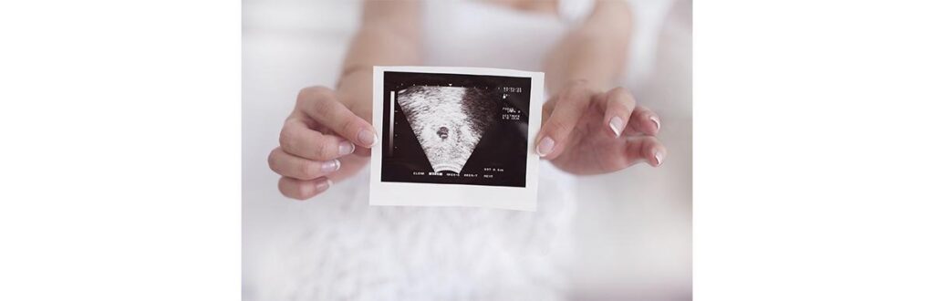 Aborto é um tema muito delicado de se abordar