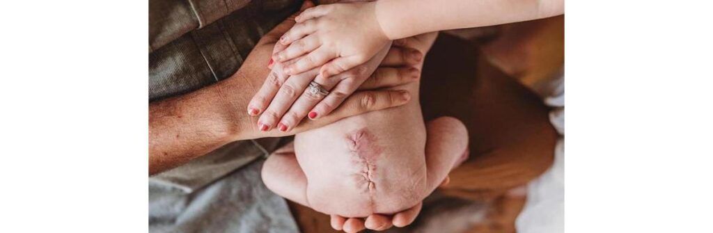 Antes de nascer, Parker precisou fazer uma cirurgia muito séria