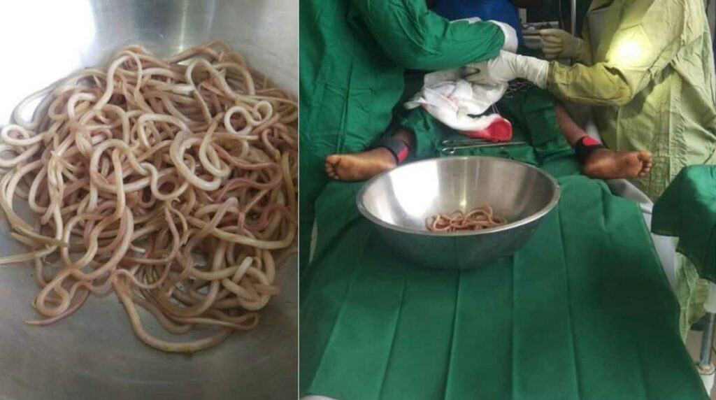 O caso aconteceu em Camarões, na África do Sul