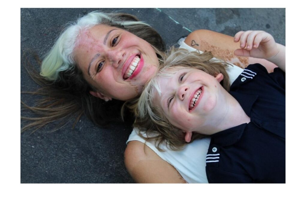 Anthony tem três anos