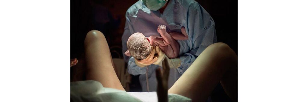 Todos os tipos de parto têm riscos e podem ocorrer complicações, até mesmo o natural