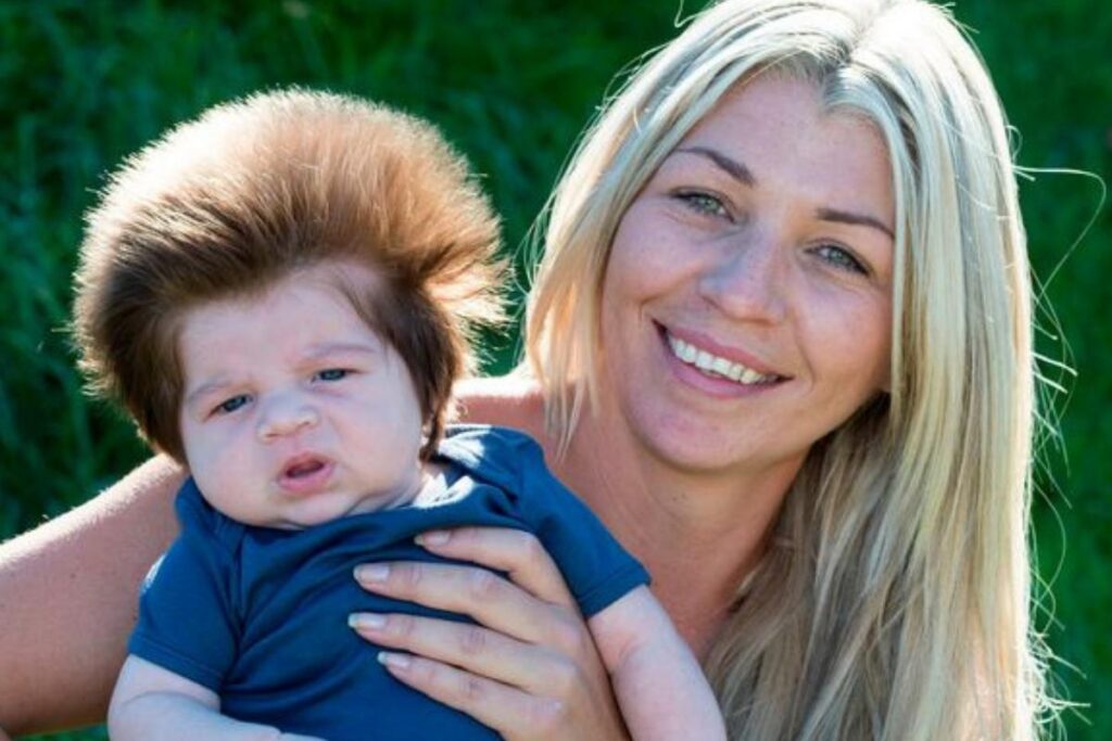 O antes e depois do bebê