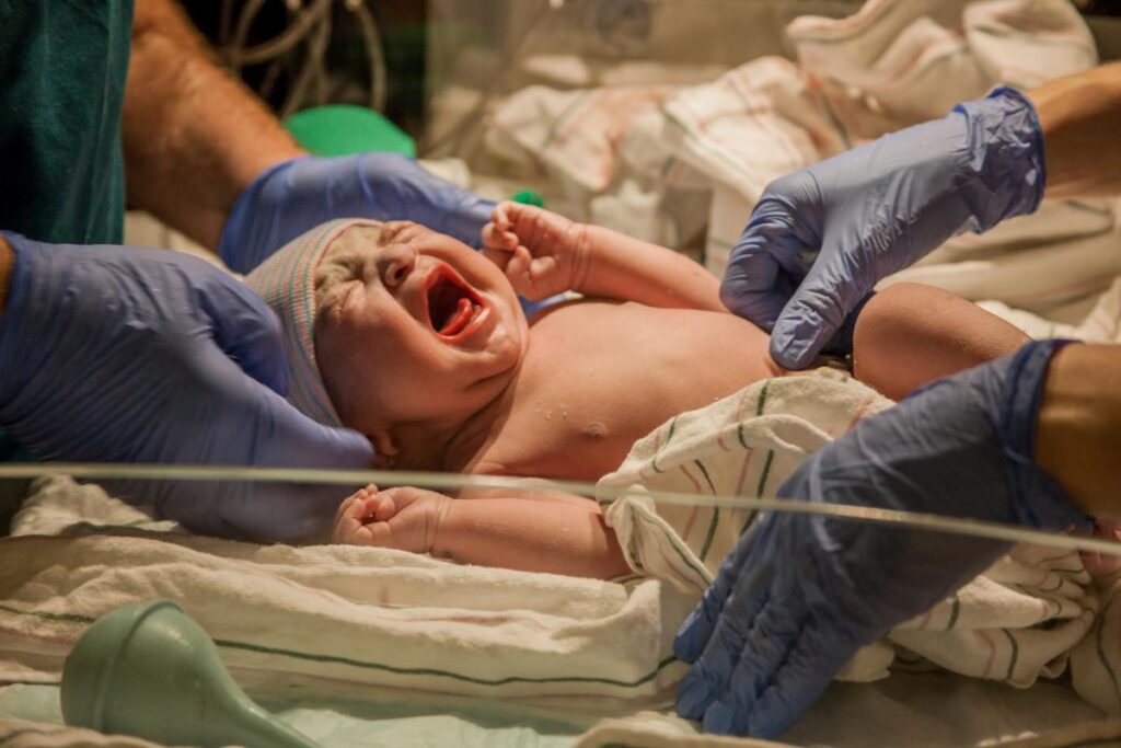 Bebê teve complicações na circuncisão / Imagem ilustrativa