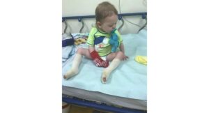 Pai usa acidente com o filho para fazer alerta