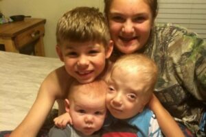 Grayson Kole Smith nasceu com uma condição rara