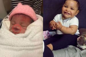 A menina ainda está em tratamento