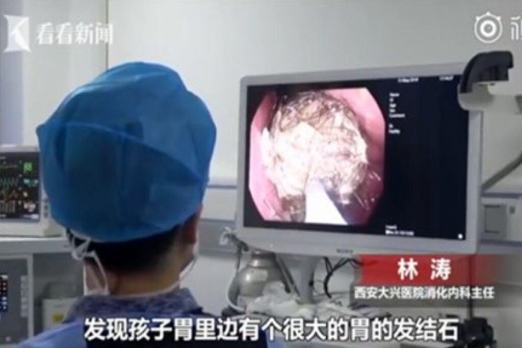 Imagens da endoscopia realizada na chinesa Xio Lin