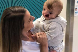 Menino nasce com fissura labial e problemas cardíacos