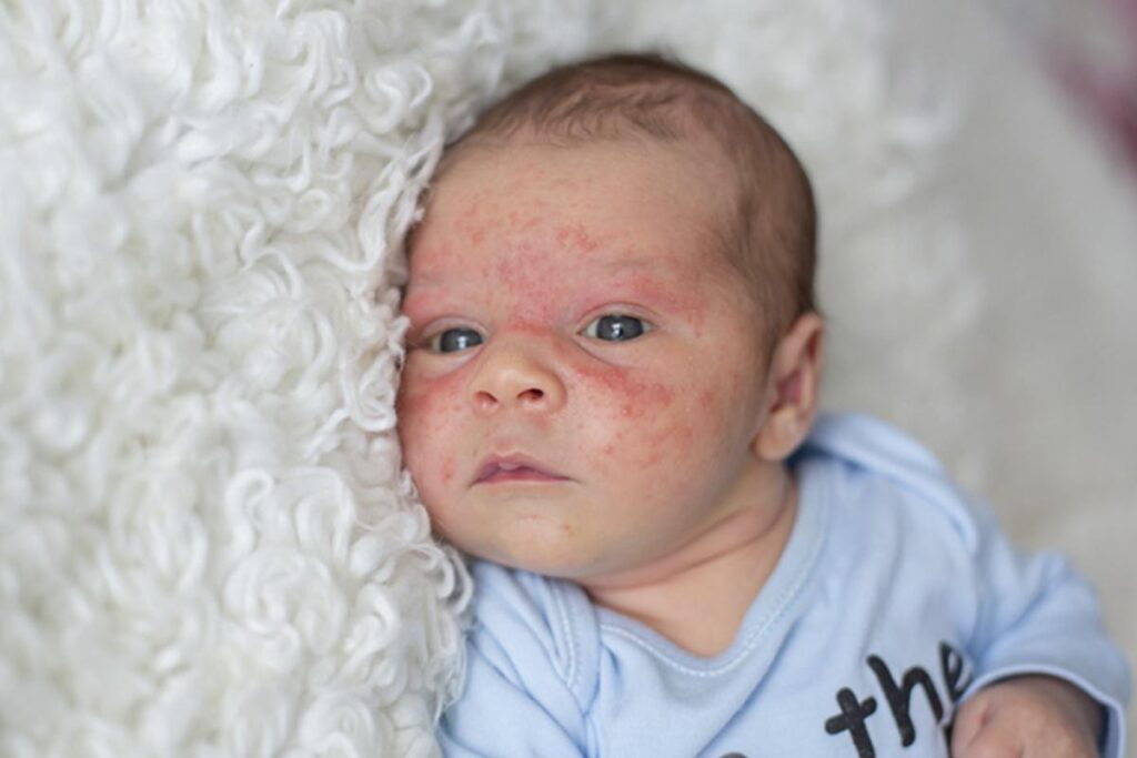 Amamentação é muito importante nos primeiros dias de vida do bebê