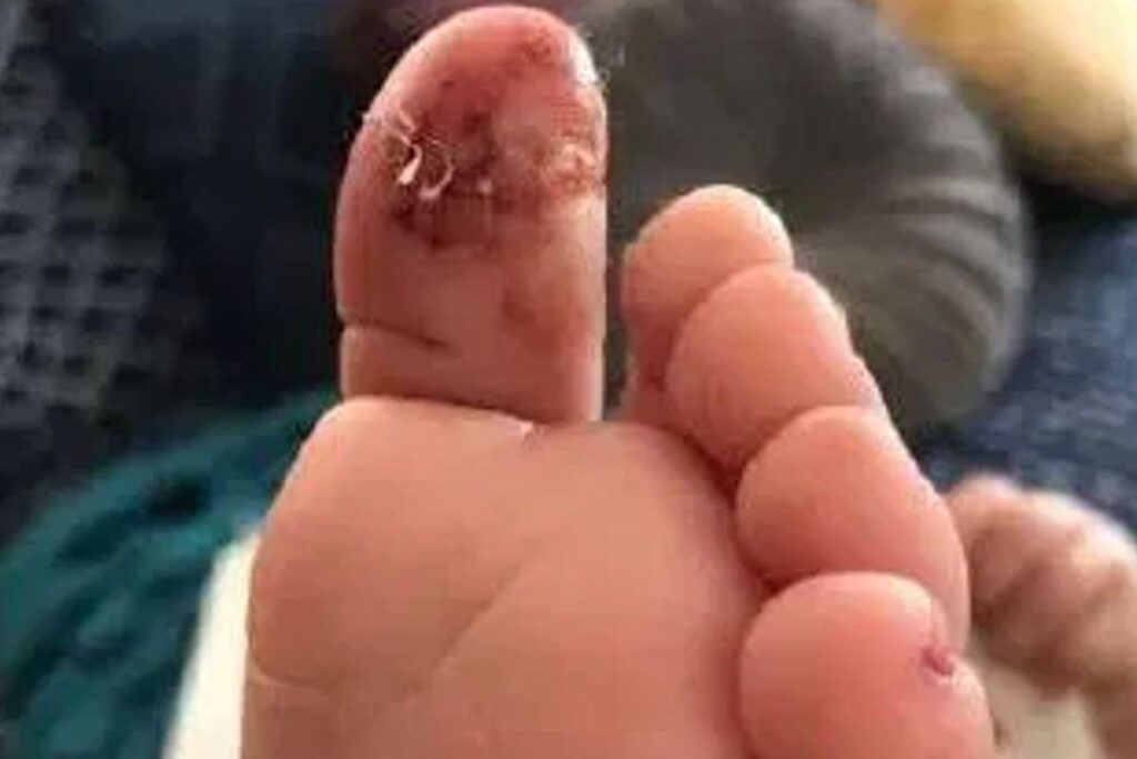 A creche colocou lenços de papel no dedo da criança