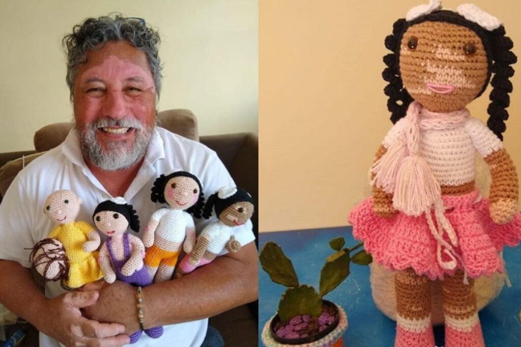 Avô com vitiligo cria bonecos inclusivos